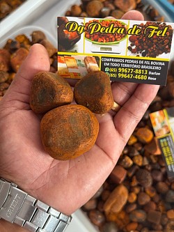 Pedras de fel bovino